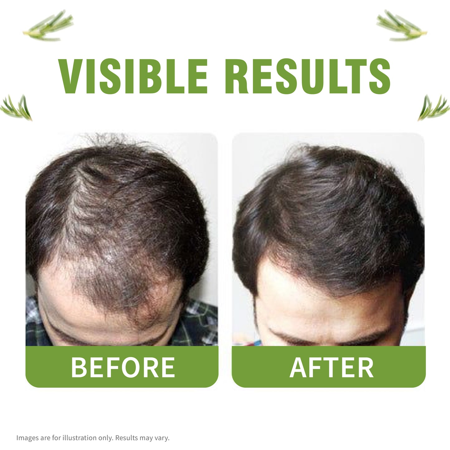 Advanced Hair Tonic