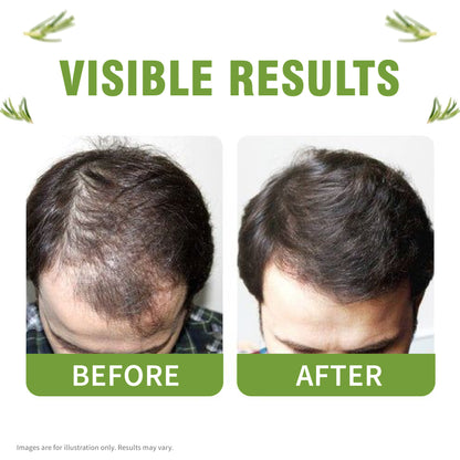 Advanced Hair Tonic